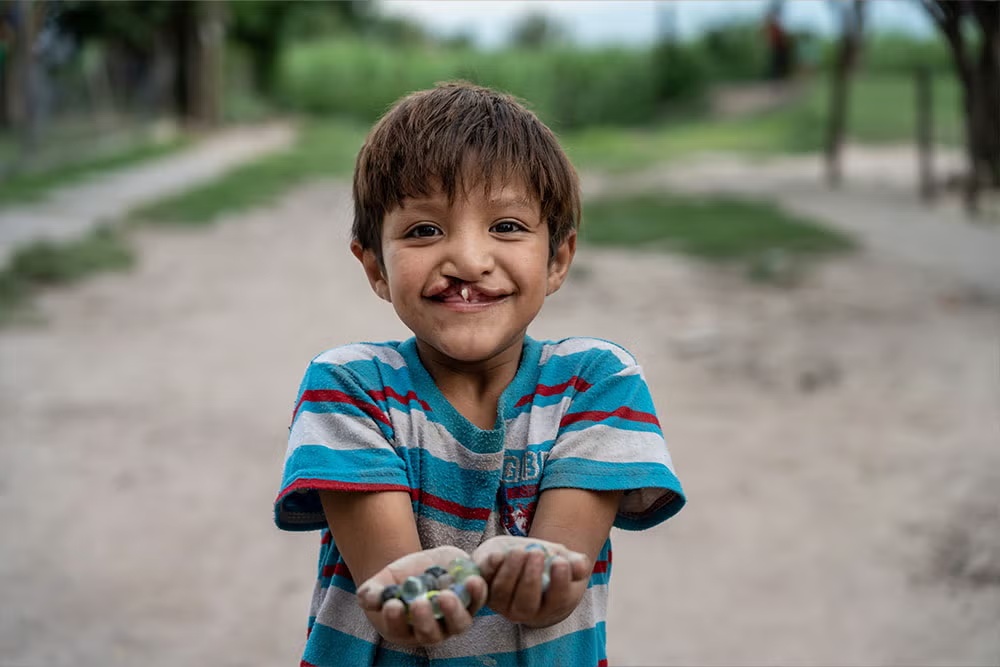 Smile Train / Samir